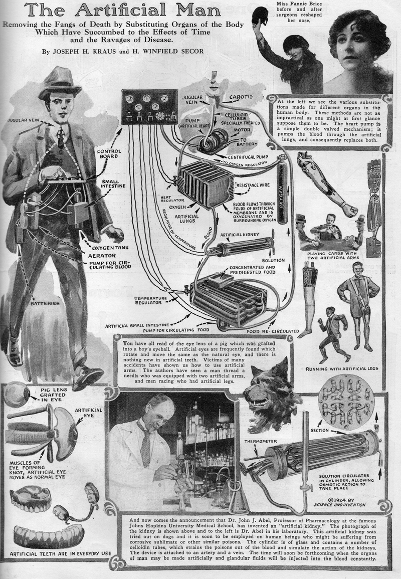 Illustration for article titled Building a Cyborg in the Roaring Twenties